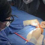 UMAE 71 del IMSS devuelve la audición a un bebé con el primer implante coclear bilateral realizado en el norte del país